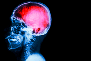 especializacion-en-neurocirugia.jpg