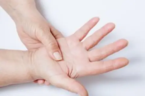 Especialización en Cirugía de Mano