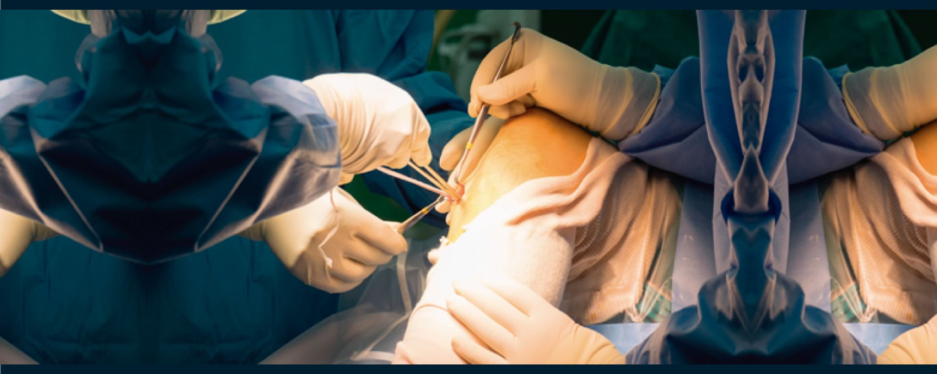 Especialización en Cirugía Vascular Periférica