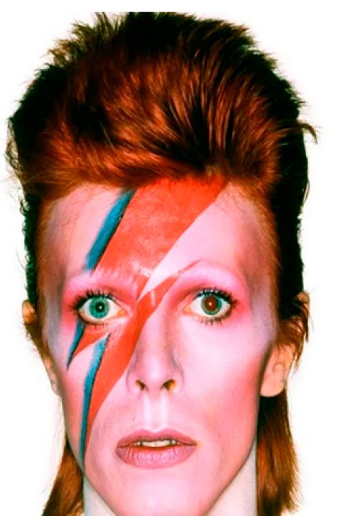 La estética alienígena de Bowie se vio favorecida por su desafortunado accidente. 