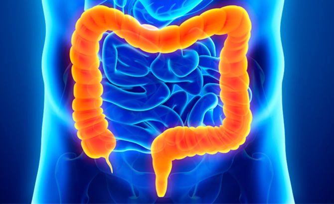 Especialización en Coloproctología