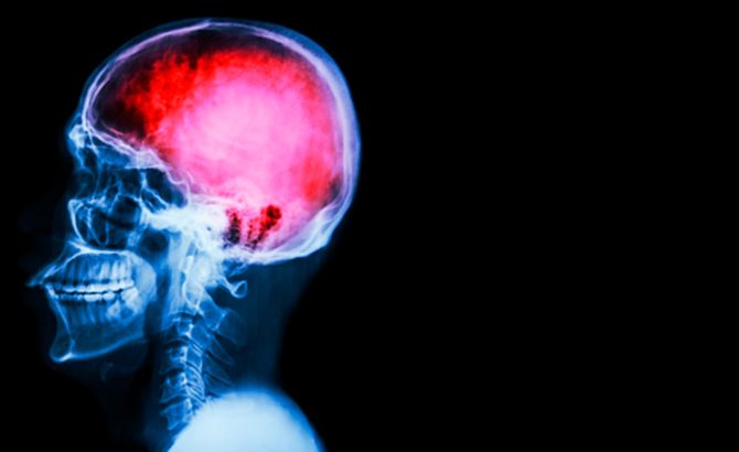 Especialización en Neurocirugía